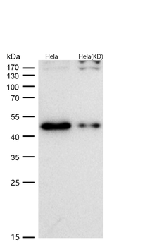 TDP43 Rabbit mAb [KD Validated] Antibody