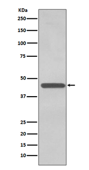 TDP43 Rabbit mAb [KD Validated] Antibody