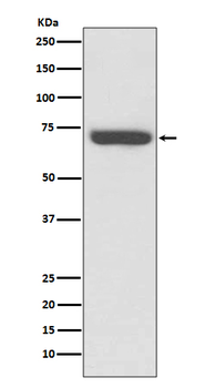 TNF Receptor II Rabbit mAb Antibody