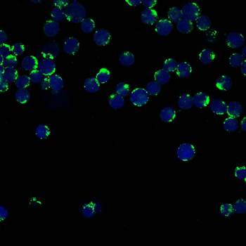 CD147 Rabbit Monoclonal Antibody