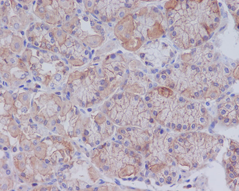 CD147 Rabbit Monoclonal Antibody