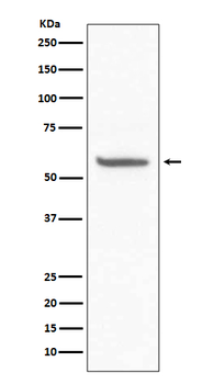 CD147 Rabbit Monoclonal Antibody
