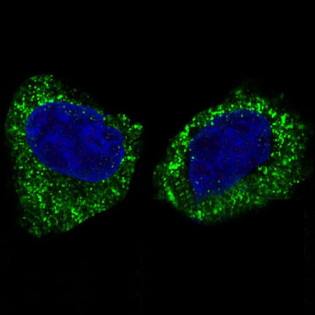 IKK beta Rabbit mAb Antibody