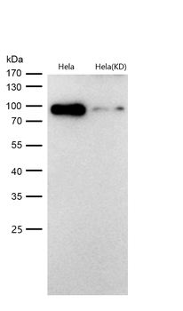 KMT6 / EZH2 Rabbit mAb [KD Validated]