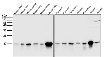 LC3B Rabbit mAb Antibody