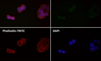 LC3B Rabbit mAb Antibody