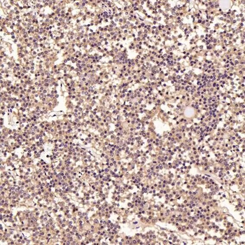 LC3B Rabbit mAb Antibody