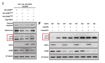 LC3B Rabbit mAb Antibody