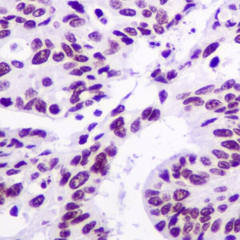 ARID1A Rabbit mAb [KD Validated] Antibody