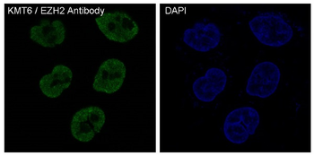 KMT6/EZH2 Rabbit Monoclonal Antibody