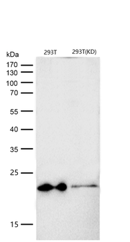 HSPB8/HSP22 Rabbit mAb [KD Validated] Antibody