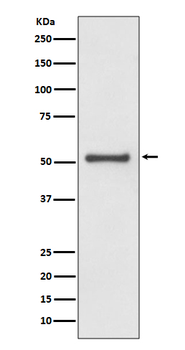 TRAF2 Rabbit mAb Antibody