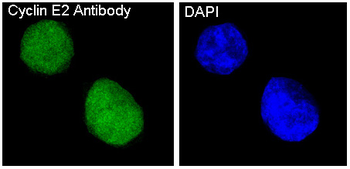 Cyclin E2 Rabbit Monoclonal Antibody
