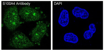 S100A4 Rabbit Monoclonal Antibody