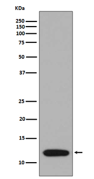 S100A4 Rabbit Monoclonal Antibody