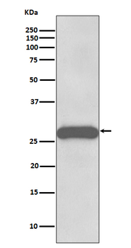PPP1R1A Rabbit mAb Antibody