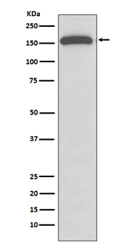 Gli1 Rabbit mAb Antibody