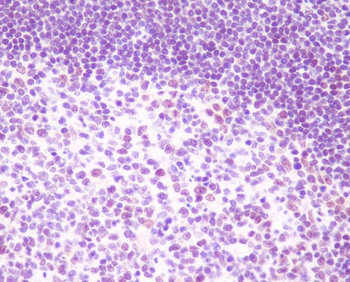 RelB Rabbit mAb Antibody