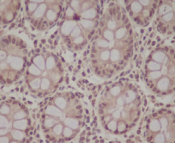 pro Caspase 9 Rabbit mAb Antibody