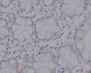 pro Caspase 3 Rabbit mAb Antibody