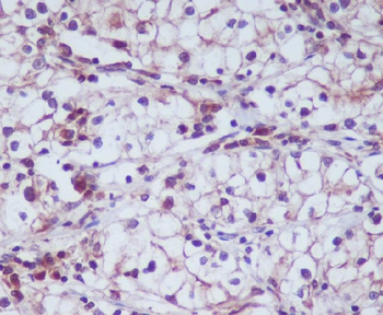 CD13 Rabbit Monoclonal Antibody