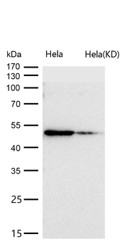 ADIPOR1 Rabbit mAb [KD Validated] Antibody