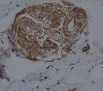 CD14 Rabbit Monoclonal Antibody