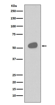 CD14 Rabbit Monoclonal Antibody