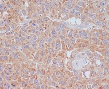 ATG9A Rabbit mAb [KD Validated] Antibody