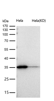 Annexin A10 Rabbit mAb [KD Validated] Antibody