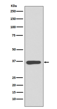 Annexin A10 Rabbit mAb [KD Validated] Antibody