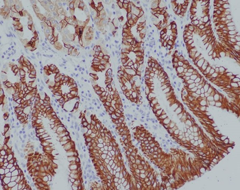 Cytokeratin 14 Rabbit Monoclonal Antibody