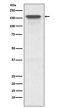 P Glycoprotein Rabbit Monoclonal Antibody