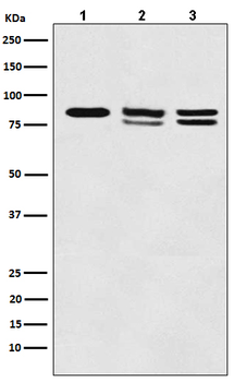 IKK alpha+beta Rabbit mAb Antibody