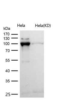 Catenin alpha 1 Rabbit mAb [KD Validated] Antibody