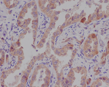 Catenin alpha 1 Rabbit mAb [KD Validated] Antibody