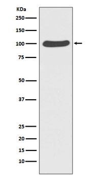 Catenin alpha 1 Rabbit mAb [KD Validated] Antibody
