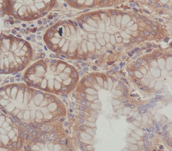SCF Rabbit Monoclonal Antibody