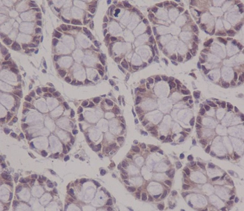APC Rabbit mAb Antibody