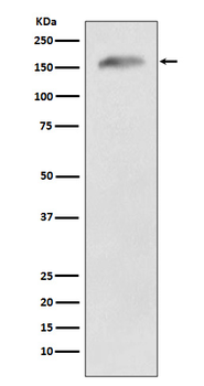 APC Rabbit mAb Antibody