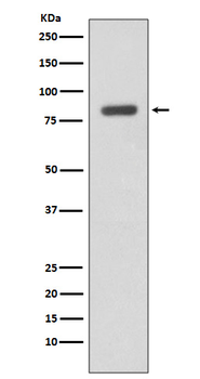 IKK beta Rabbit mAb Antibody