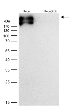 Fibronectin Rabbit mAb [KD Validated]