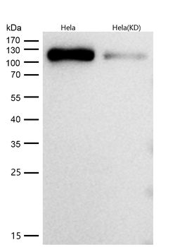 Daxx Rabbit mAb [KD Validated] Antibody