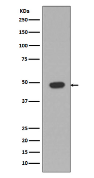 GFAP Rabbit mAb