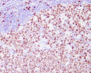 Ki67 Rabbit mAb