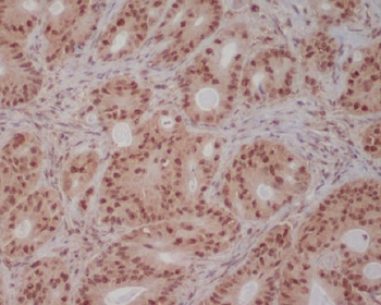 PI 3 Kinase p85 beta Rabbit Monoclonal Antibody