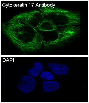 Cytokeratin 17 Rabbit Monoclonal Antibody