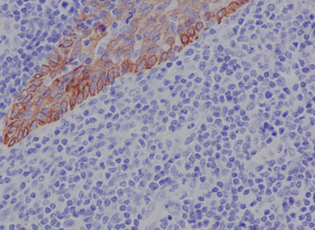 Cytokeratin 17 Rabbit Monoclonal Antibody