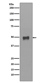 Cytokeratin 17 Rabbit Monoclonal Antibody