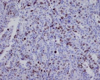 Survivin Rabbit mAb Antibody